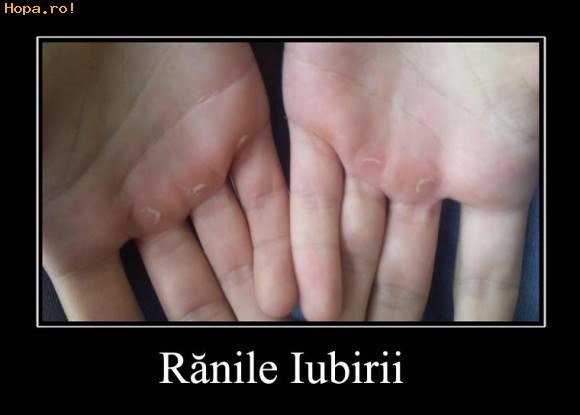 Diverse - Ranile iubirii