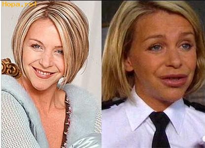 Celebritati - Lesley Ash - prea mult botox